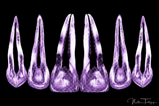 Composición de dientes morados